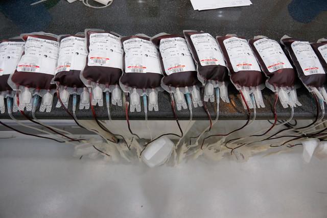 فراوان ترین و کمیاب ترین گروه های خونی مربوط به چه کسانی است؟